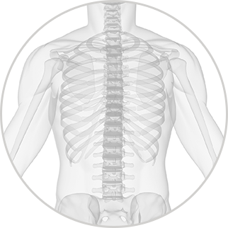 spinal fusion